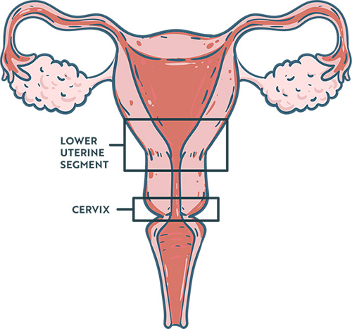 Uterus Diagram